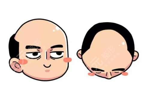 纹发的副作用及危害有什么?