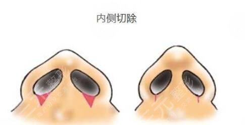 李安平医生擅长项目