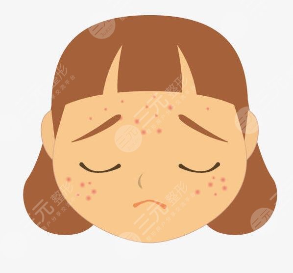 如何快速去除痤疮见效快?