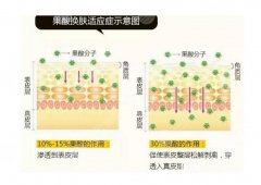 祛除痘印的方法有哪些？果酸换肤效果好吗？