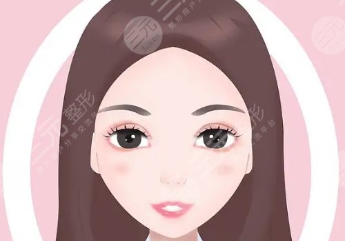 苹果肌太大怎么改良？