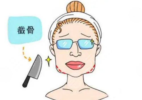 如何塑造下颌线?
