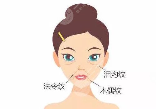 法令纹太深了有什么解决办法？