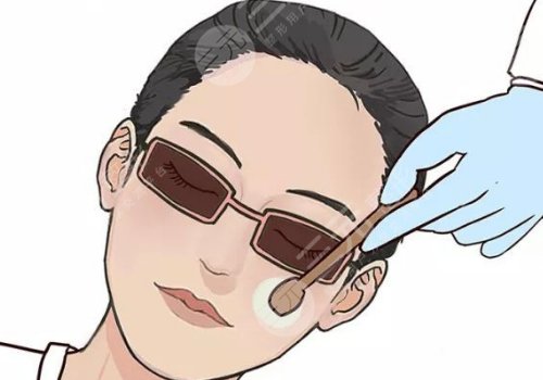 法令纹太深了有什么解决办法？