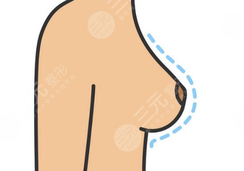 奥美定取出手术后要注意些什么？