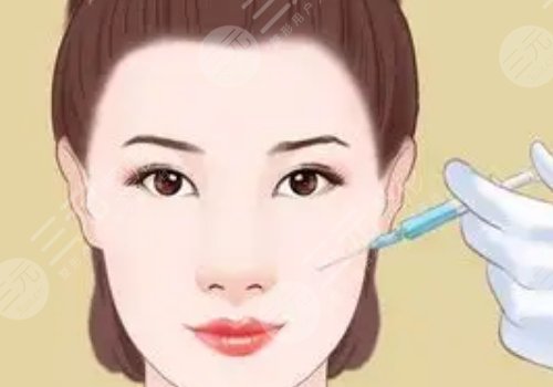 注射宝尼达玻尿酸多长时间可以洗脸？