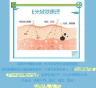 e光嫩肤的价格是多少？费用参考！美肤术前术后注意~