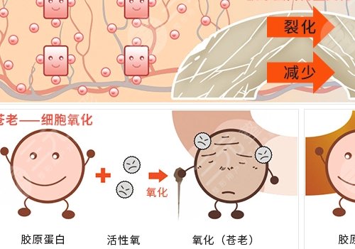 薇旖美三型胶原蛋白价格是多少？