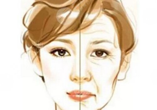 薇旖美三型胶原蛋白价格是多少？