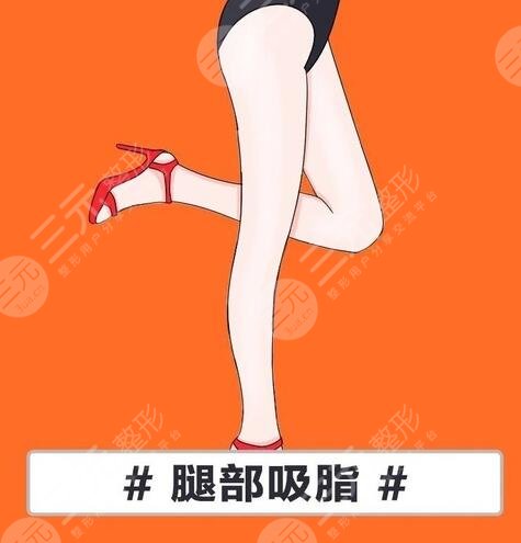 腿部吸脂减肥是什么?