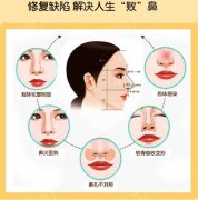 鼻子修复大概多少钱?价格表参考!隆鼻失败必看干货! 鼻子修复大概多少钱?价格表参考!隆鼻失败必看干货!