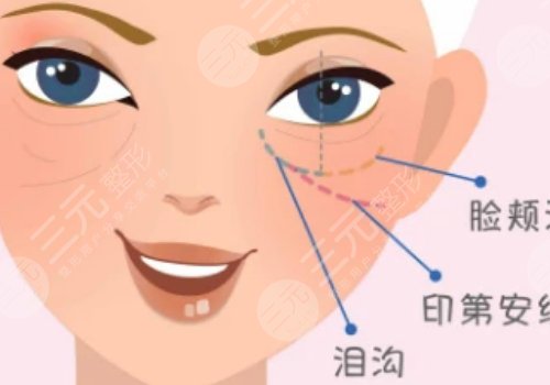 重庆华美做眼袋手术好的医生