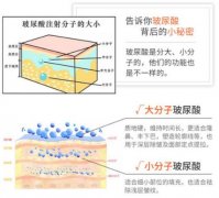 注射玻尿酸有什么副作用?美容有风险,打针别盲目! 注射玻尿酸有什么副作用?美容有风险,打针别盲目!