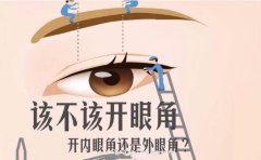 开眼角手术方法有哪些？3种常用术式图解！