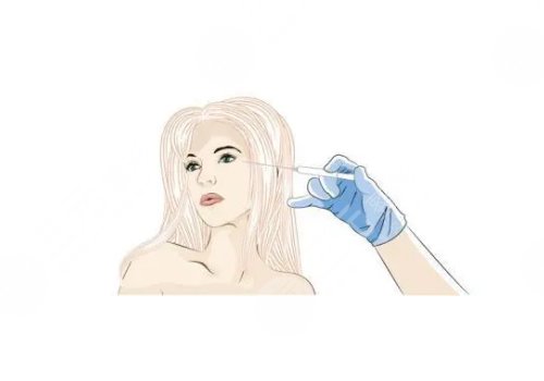 婕尔玻尿酸可以打哪些部位？