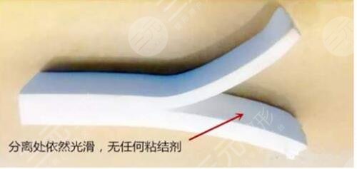 假体隆鼻手术术后如何去护理?