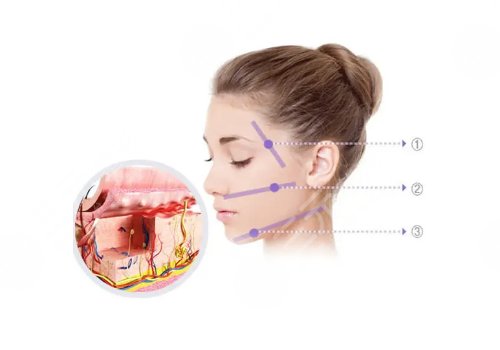 湘雅医院整形科价目表