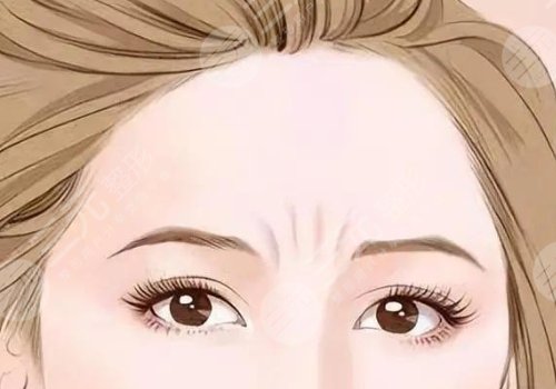 如何去除抬头纹？