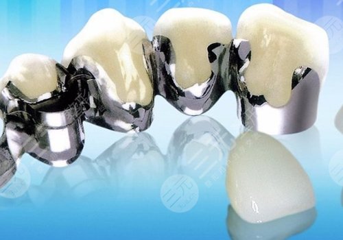 钴铬烤瓷牙和全瓷牙哪个好？