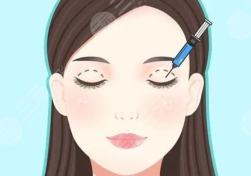 双眼皮手术多久能恢复自然?