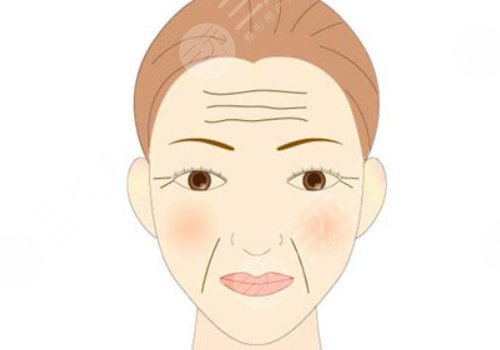 玻尿酸填充法令纹有危害吗？