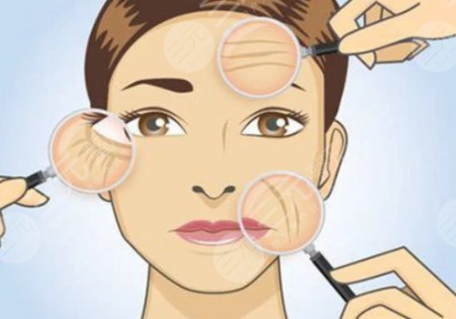 玻尿酸填充法令纹有危害吗？