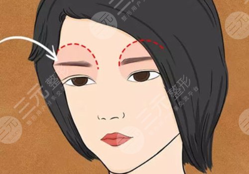 爱贝芙注射眉骨什么时候有效果?