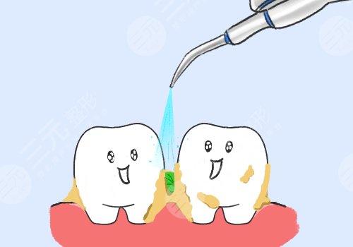 洗牙的危害与好处有哪些？