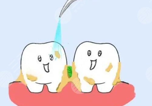 洗牙的危害与好处有哪些？
