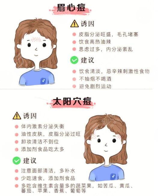 快速祛痘小窍门有哪些?