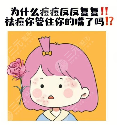 快速祛痘小窍门有哪些?