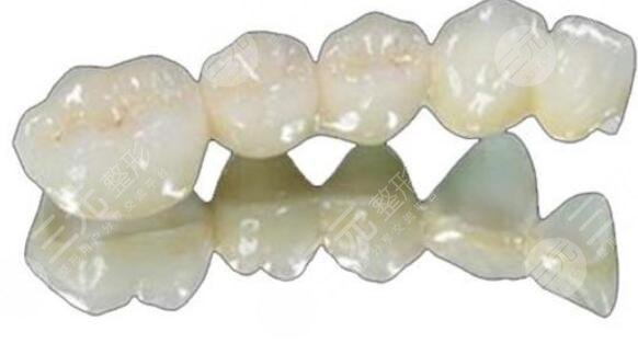 温州牙科医院收费高吗多少钱现在?