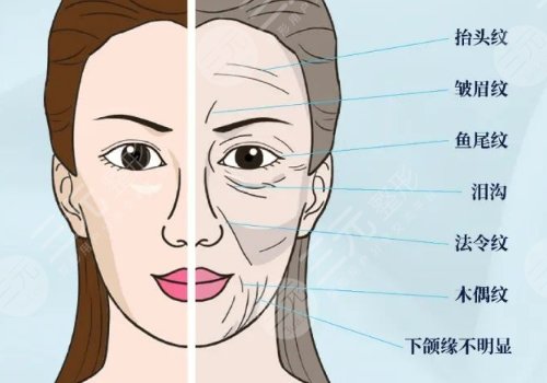 玻尿酸填充脸部有什么危害?