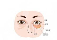 玻尿酸填充泪沟多久可以恢复自然？维持多久？