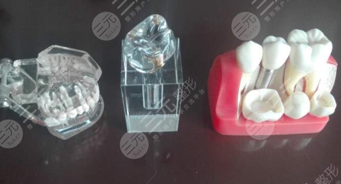 韩国登腾种植牙使用寿命是多长?