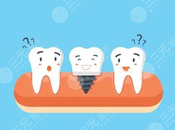 种牙材质都有哪些品牌好?