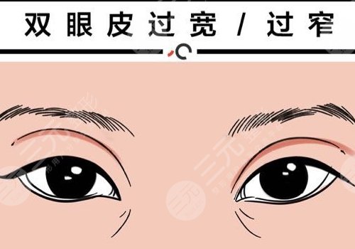 双眼皮修复大概多少钱呢?