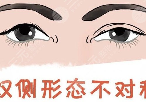 双眼皮修复大概多少钱呢?