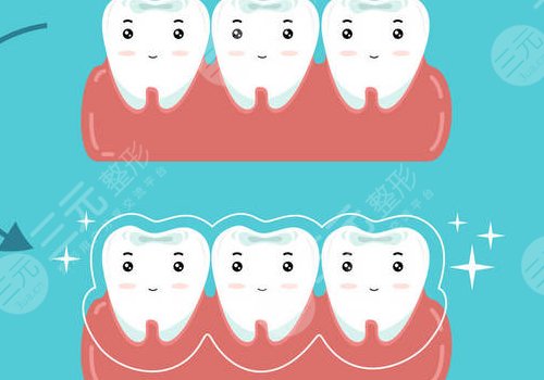 钴铬烤瓷牙齿的优缺点是什么？