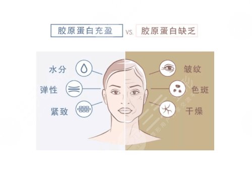 胶原蛋白填充脸部多少钱?