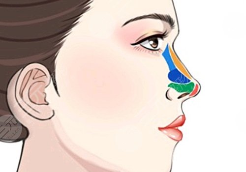 玻尿酸注射鼻头红肿和栓塞的区别是什么?