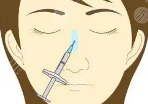 玻尿酸注射鼻头红肿和栓塞的区别是什么?