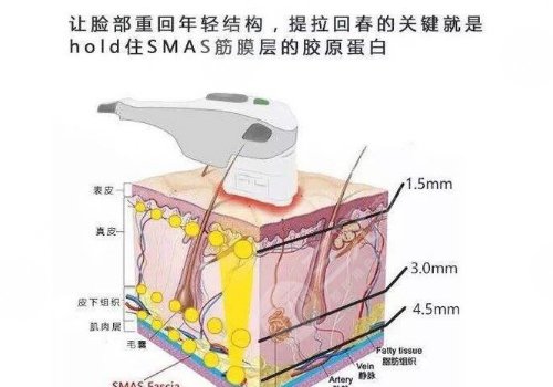 热玛吉的功效与功能有哪些？