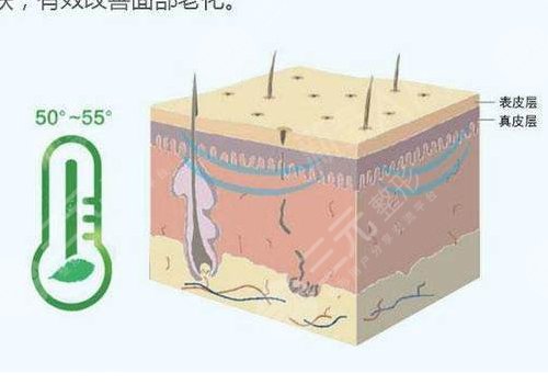 深蓝射频做一次有效果吗？