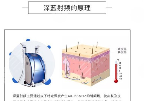 深蓝射频和热拉提哪个好？