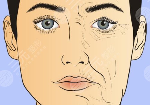 深蓝射频和热拉提哪个好？