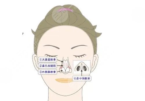 鼻小柱抬高是怎么做的？