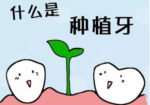 种植牙可以用社保卡报销吗？