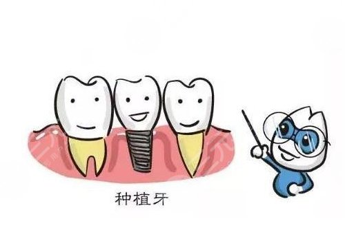 种植牙可以用社保卡报销吗？