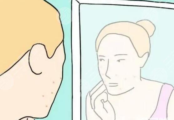 缓解青春痘的价格因素